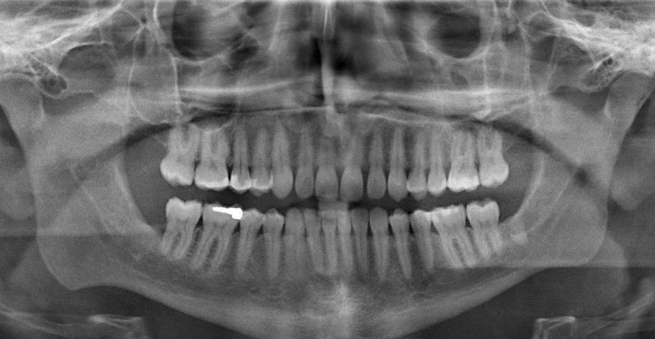 Dental X-Rays Top Rancho Cucamonga Dentist