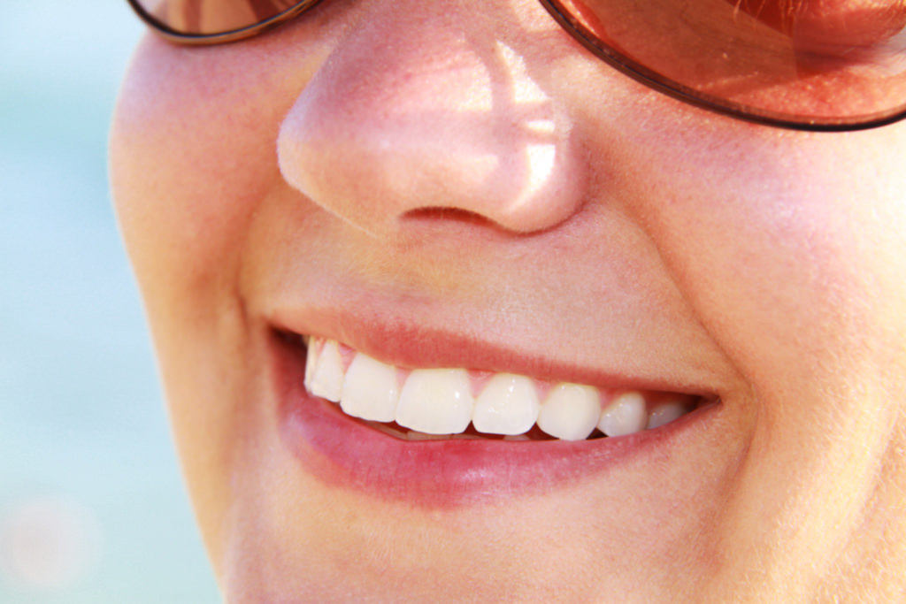Veneers Smile Teeth Restoration Rancho Cucamonga Dentist