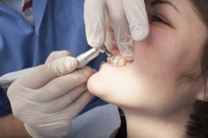 Teeth Whitening | Dental Office Rancho Cucamonga | Dentist Near Rancho Cucamonga