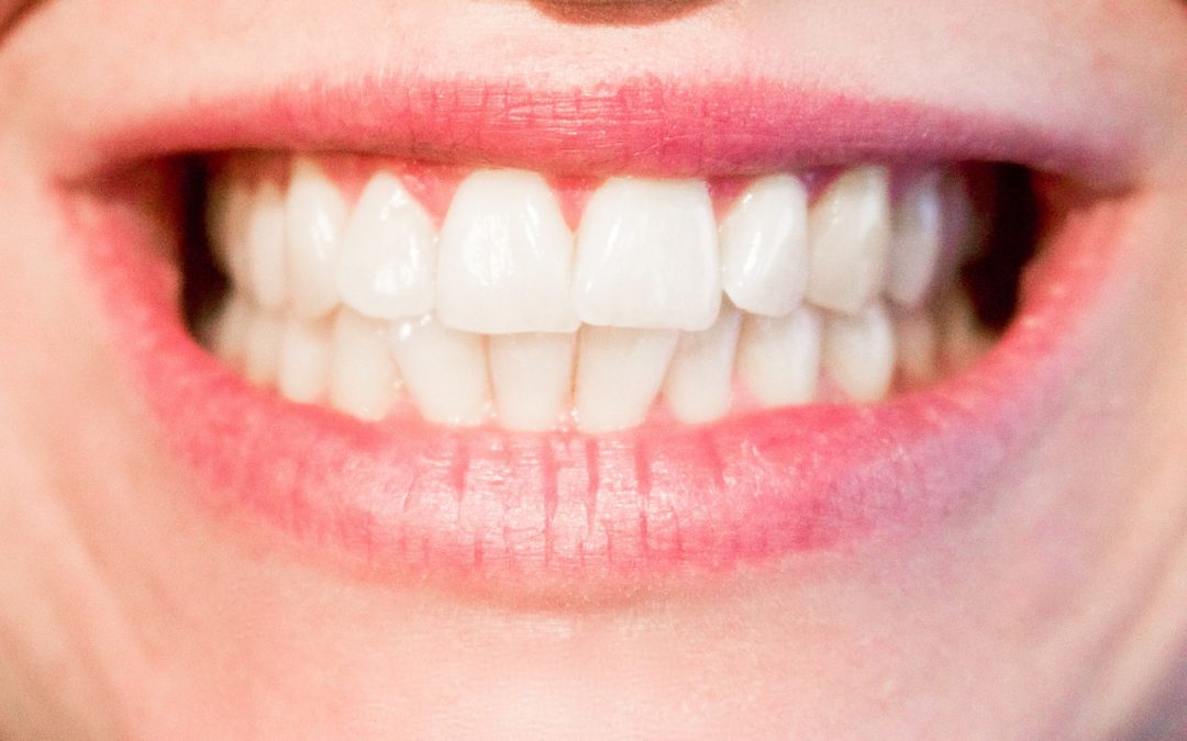 Teeth Whitening Tips | Best Rancho Cucamonga Dentist