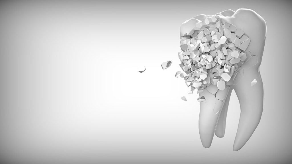 Cavity Dentist Rancho Cucamonga Dentist