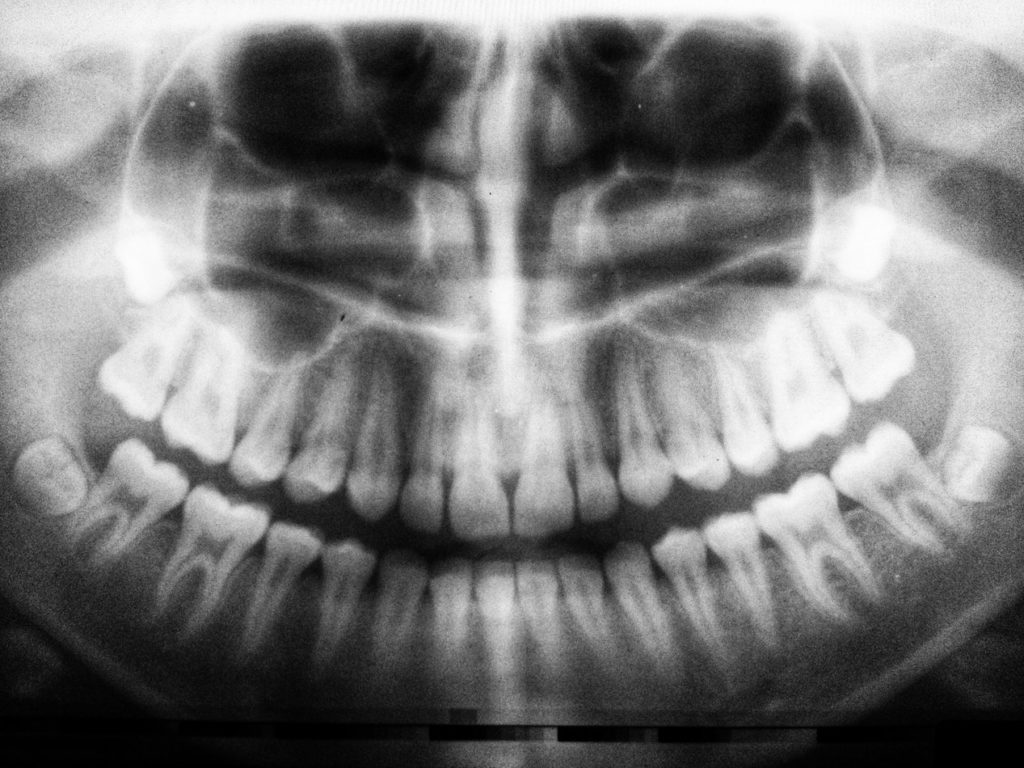 Dentists In Rancho Cucamonga CA | Rancho Cucamonga Dentists