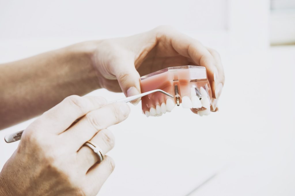 dentist in rancho cucamonga