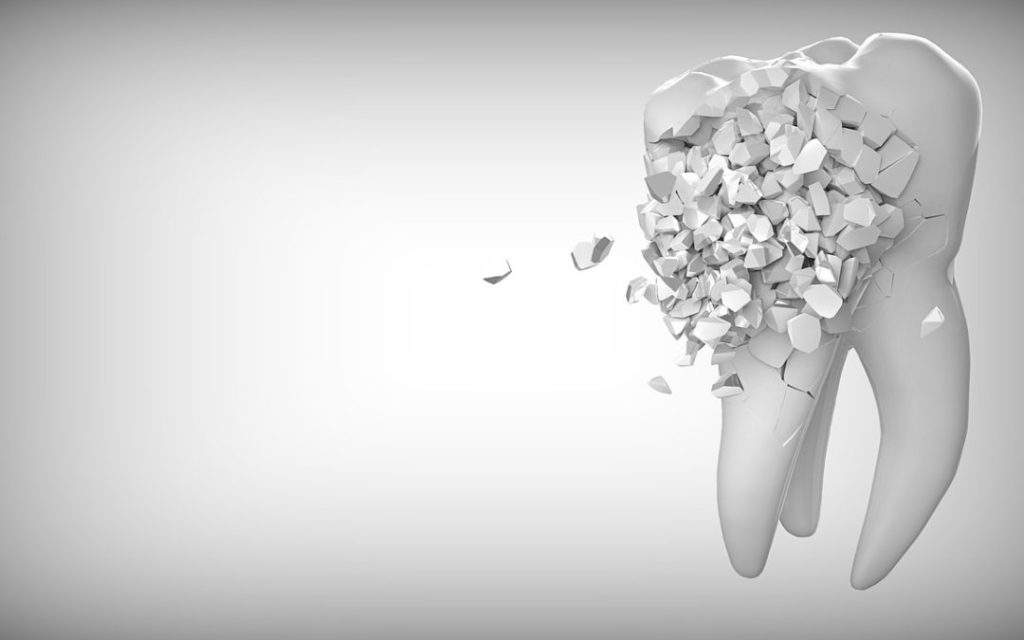 cavity dentist rancho cucamonga ca