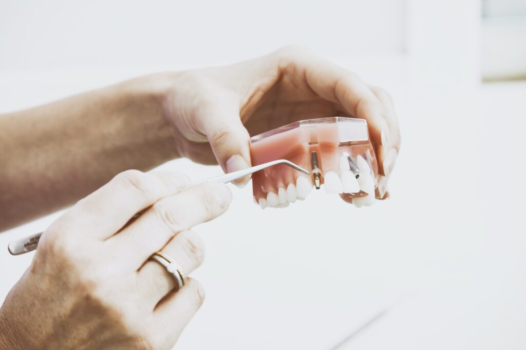 Dentist Rancho Cucamonga CA
