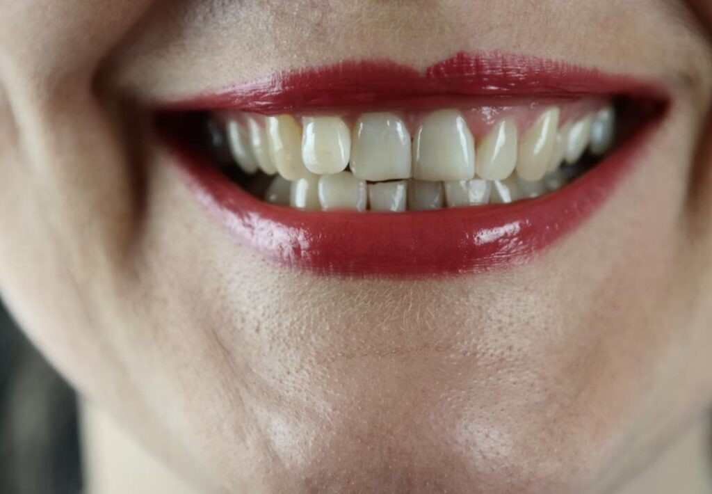 Dentist Rancho Cucamonga CA