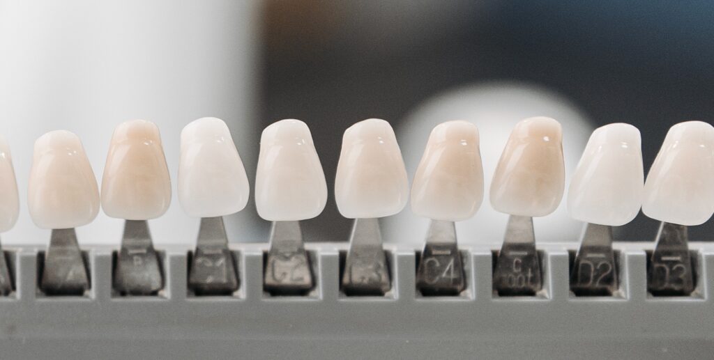 Dentist Rancho Cucamonga CA