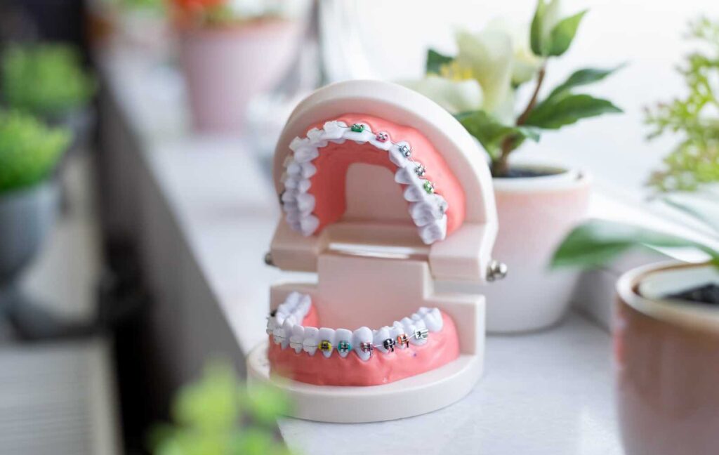 Dentist Rancho Cucamonga CA