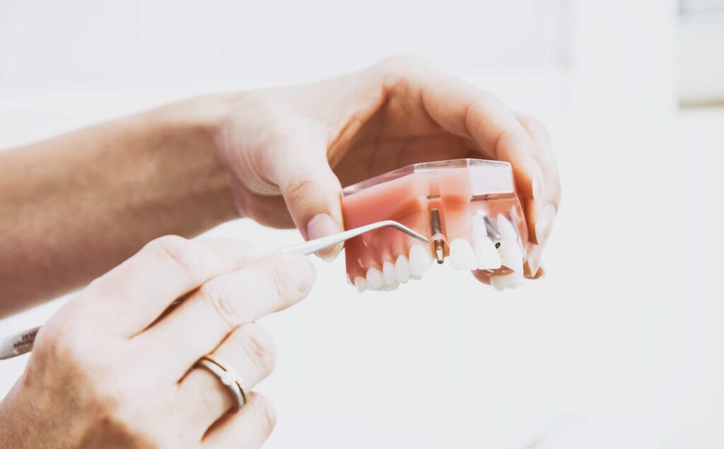 Dentist Rancho Cucamonga CA | Dentist in Rancho Cucamonga