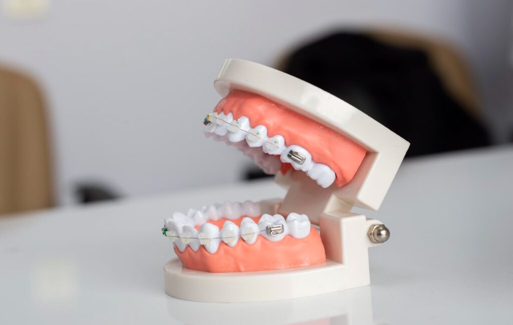 Dentist Rancho Cucamonga CA | Dentist in Rancho Cucamonga