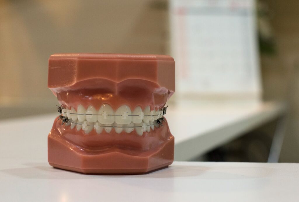 Dentist Rancho Cucamonga CA | Dentist in Rancho Cucamonga