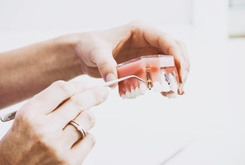 Dentist Rancho Cucamonga CA | Dentist in Rancho Cucamonga