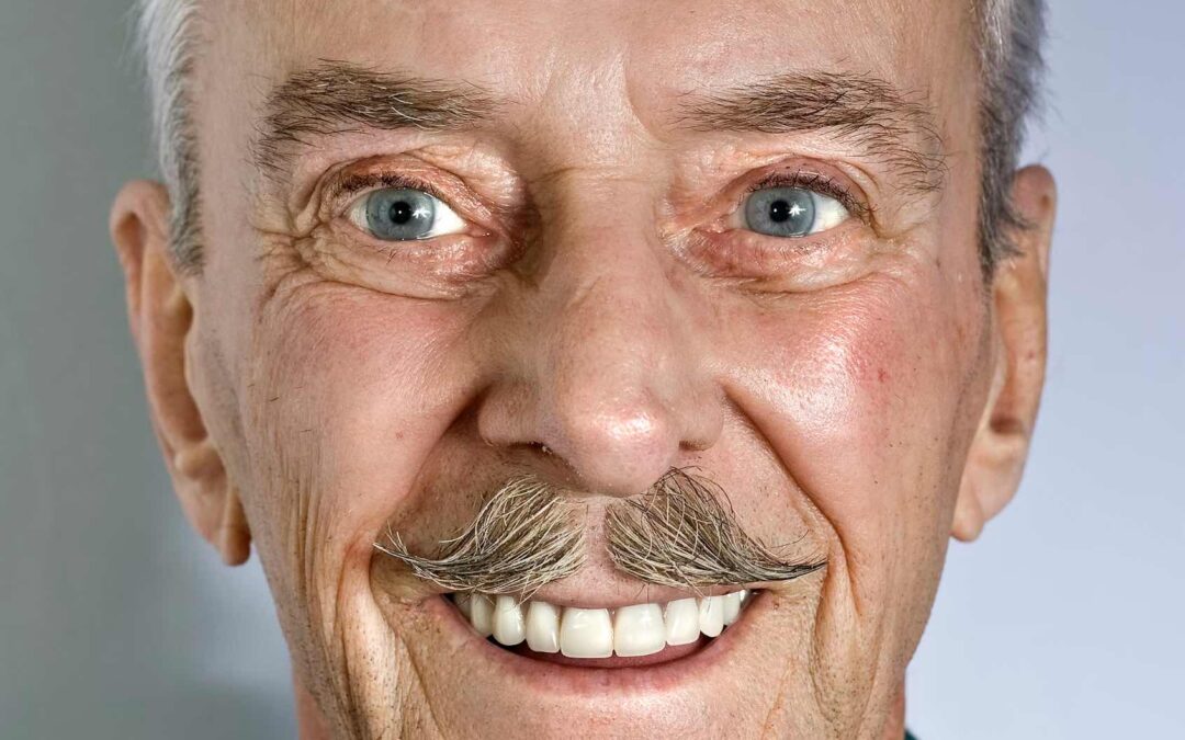 Will Veneers or Bonding Damage My Natural Teeth?