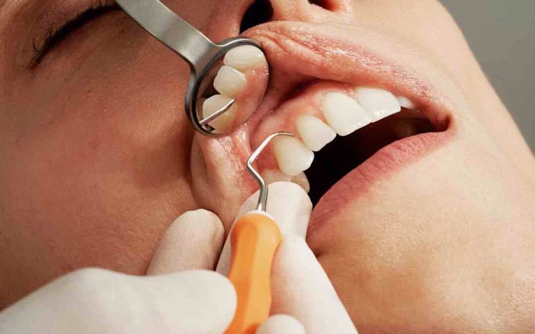 Dentist Rancho Cucamonga CA | Dentist in Rancho Cucamonga