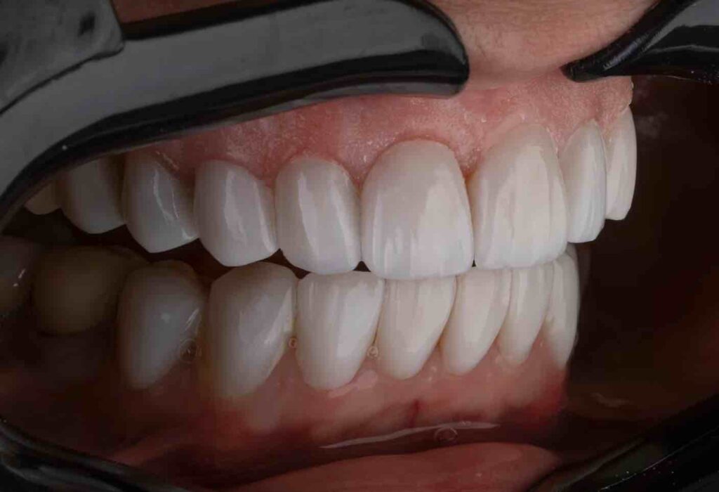 Dentist Rancho Cucamonga CA | Dentist in Rancho Cucamonga