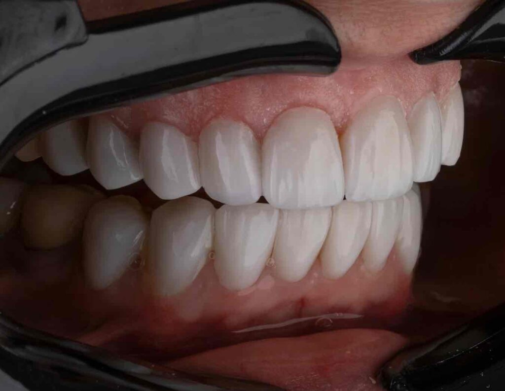 Dentist Rancho Cucamonga CA | Dentist in Rancho Cucamonga