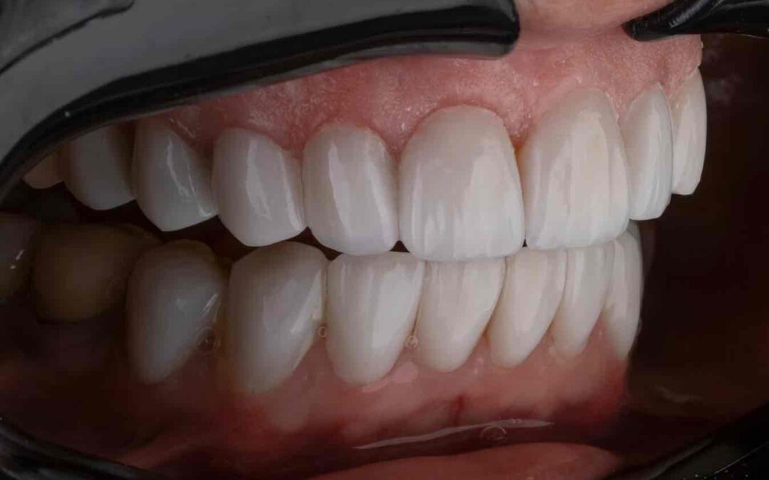 Dentist Rancho Cucamonga CA | Dentist in Rancho Cucamonga