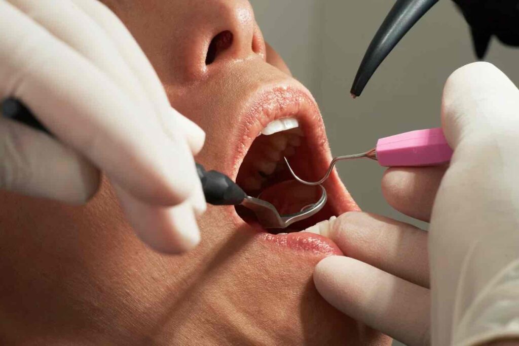 Dentist Rancho Cucamonga CA | Dentist in Rancho Cucamonga