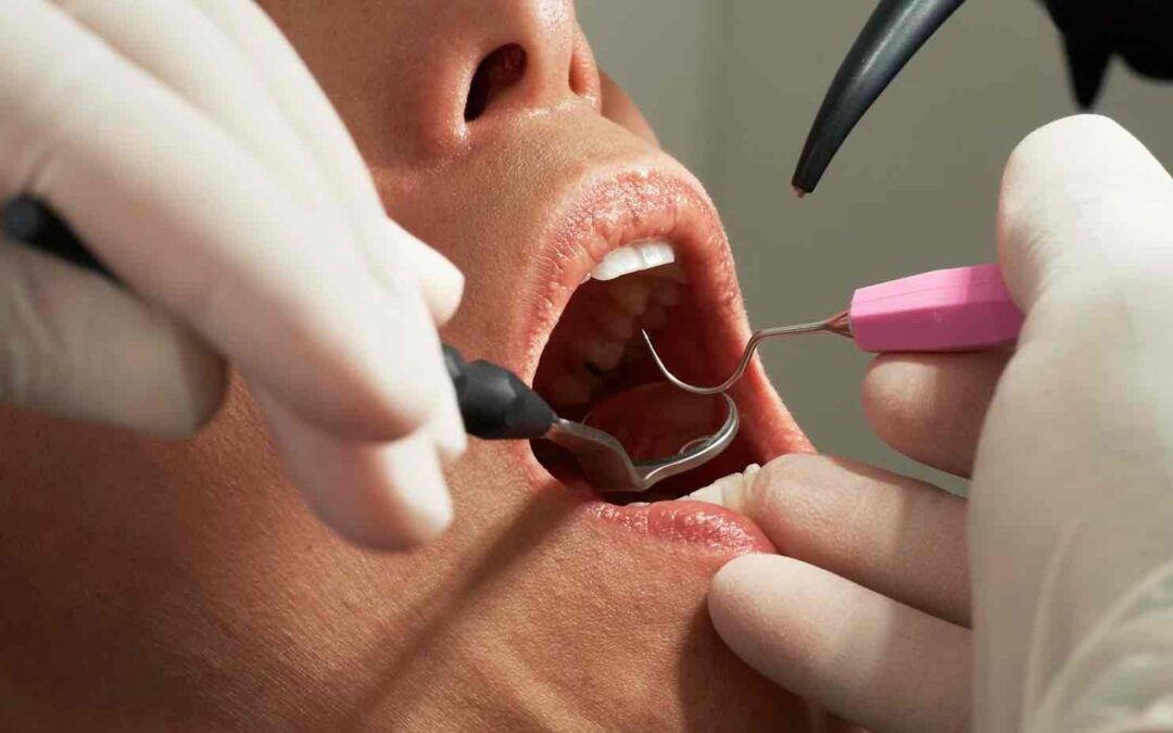 Dentist Rancho Cucamonga CA | Dentist in Rancho Cucamonga