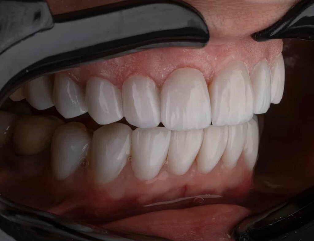 Dentist Rancho Cucamonga CA | Dentist in Rancho Cucamonga