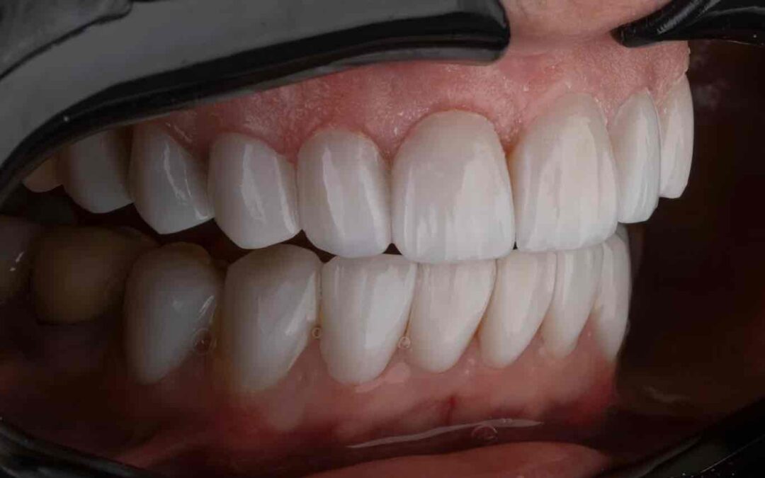 Dentist Rancho Cucamonga CA | Dentist in Rancho Cucamonga