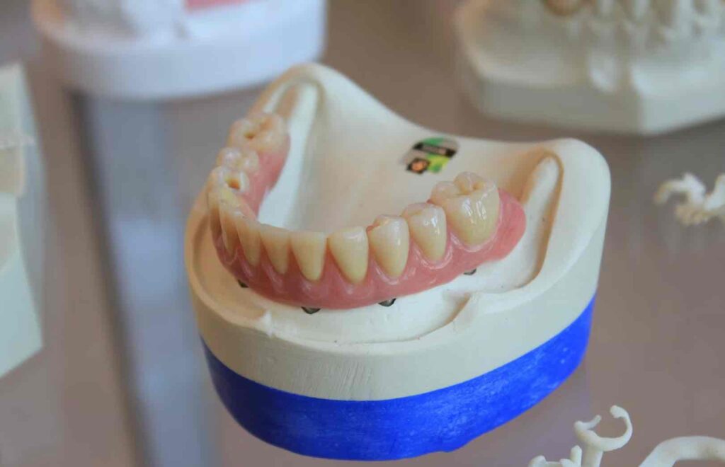 Dentist Rancho Cucamonga CA | Dentist in Rancho Cucamonga