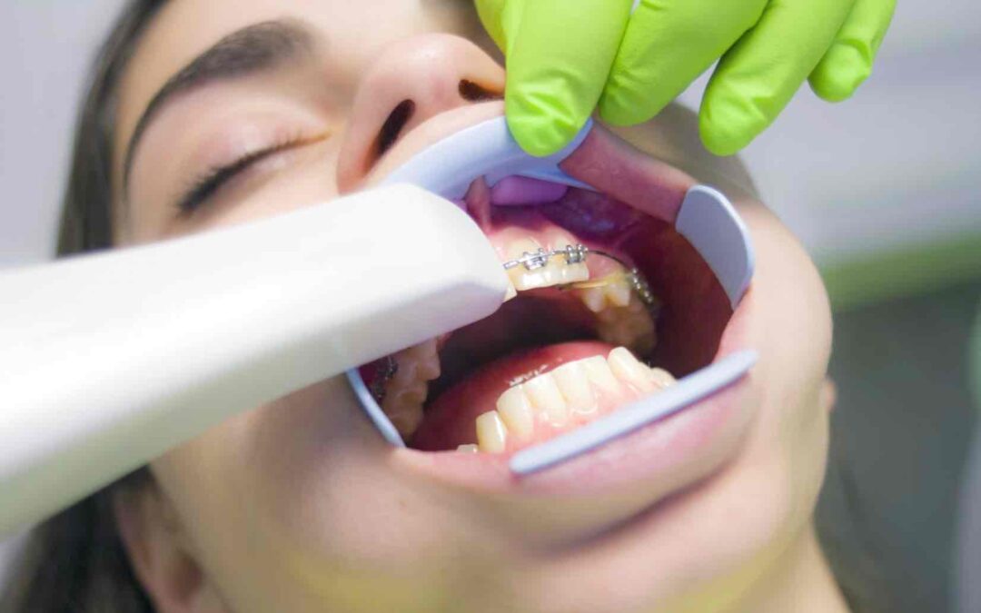Dentist Rancho Cucamonga CA | Dentist in Rancho Cucamonga