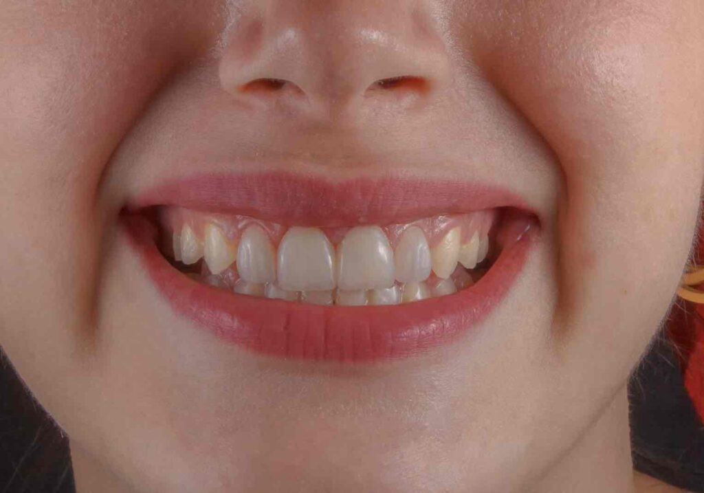 Dentist Rancho Cucamonga CA | Dentist in Rancho Cucamonga
