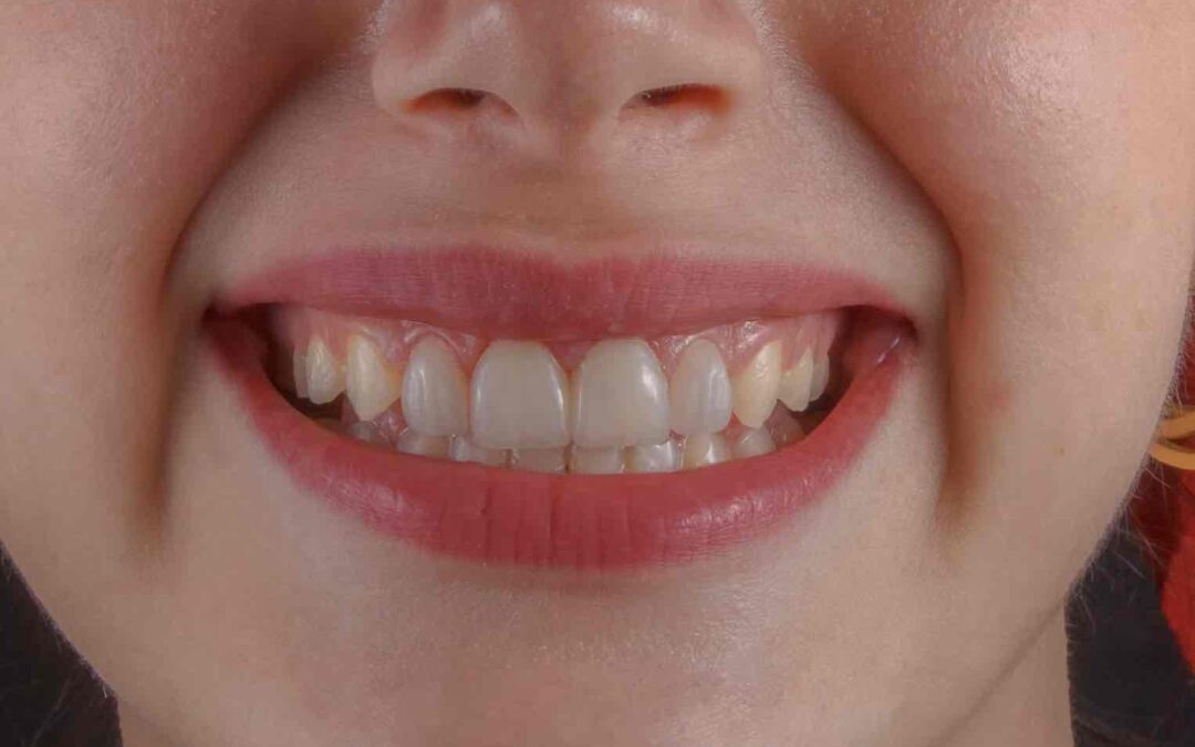 Dentist Rancho Cucamonga CA | Dentist in Rancho Cucamonga