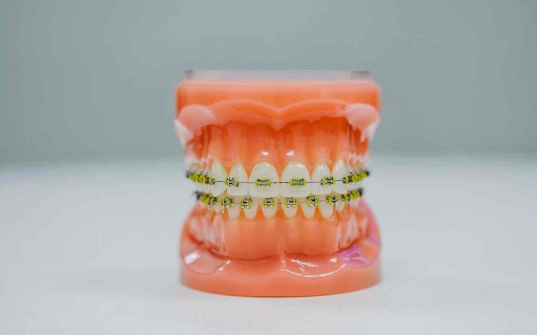 Dentist Rancho Cucamonga CA | Dentist in Rancho Cucamonga