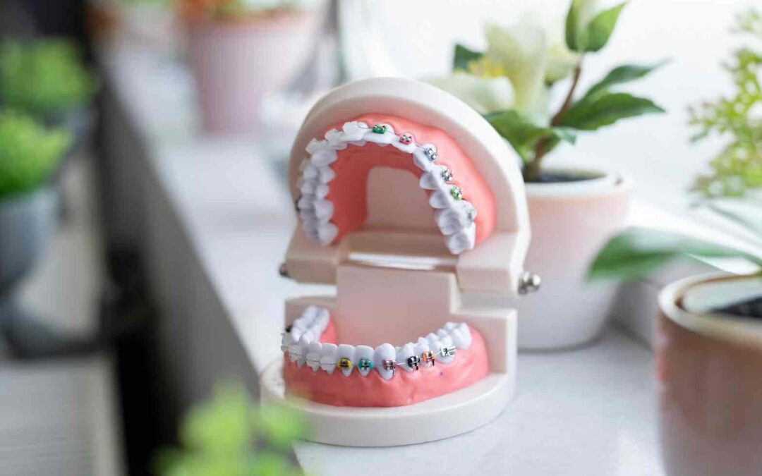 Dentist Rancho Cucamonga CA | Dentist in Rancho Cucamonga