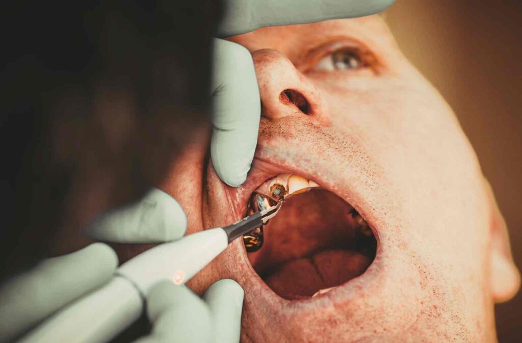 Dentist Rancho Cucamonga CA | Dentist in Rancho Cucamonga
