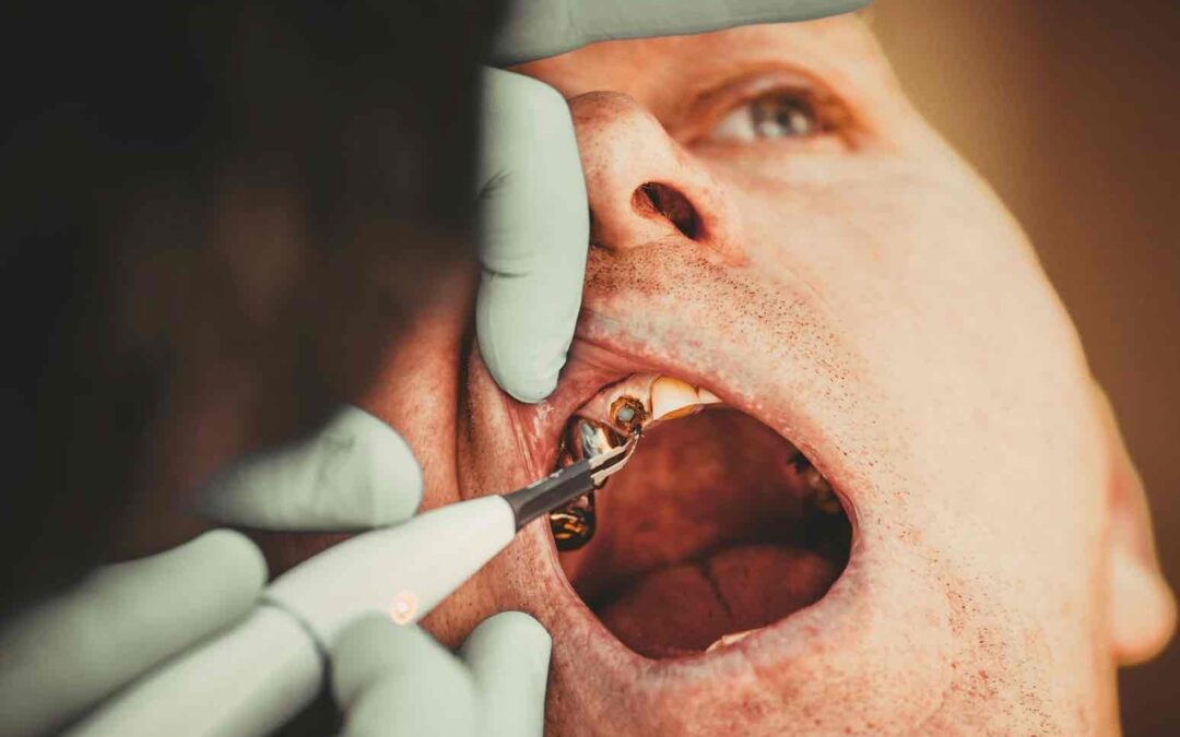 Dentist Rancho Cucamonga CA | Dentist in Rancho Cucamonga